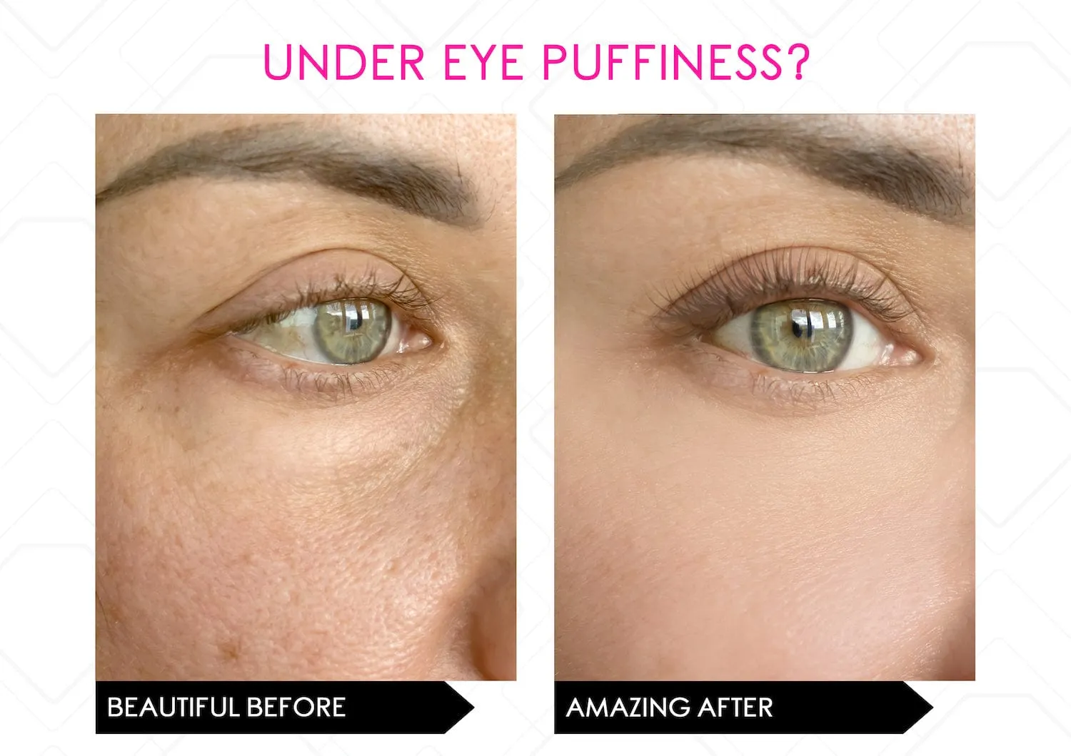i-Spresso Vibraserum (Eye Serum) Dark Circles & Puffiness- Vibrating Cooling Applicator