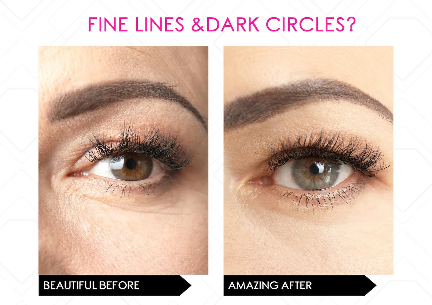 i-Spresso Vibraserum (Eye Serum) Dark Circles & Puffiness- Vibrating Cooling Applicator